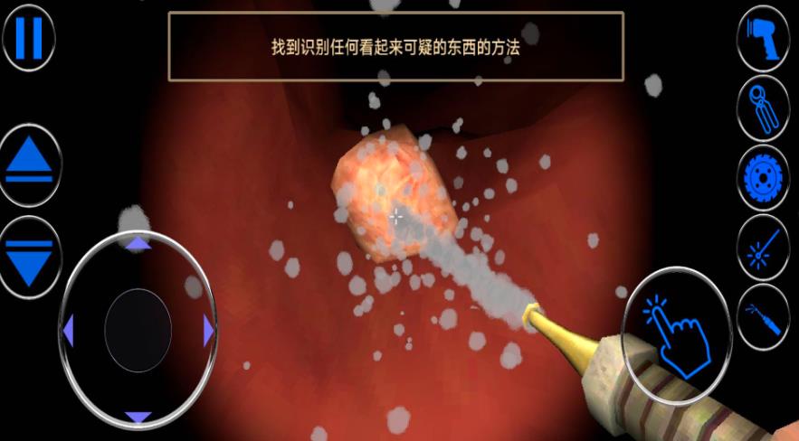 模拟肠道医生